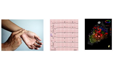 Abbildung Rhythmologie